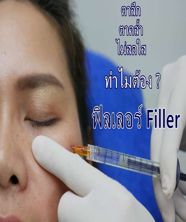 Filler ใต้ตา หมอคณิต1 - Copy